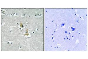 Immunohistochemistry analysis of paraffin-embedded human brain tissue, using p47 phox (epitope around residue 345) antibody. (NCF1 Antikörper  (Ser345))