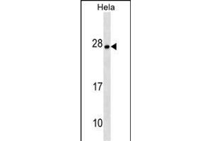 ZT4 Antibody (N-term) (ABIN1538915 and ABIN2849800) western blot analysis in Hela cell line lysates (35 μg/lane). (ZMAT4 Antikörper  (N-Term))