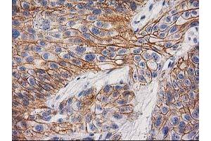 Image no. 1 for anti-Catenin (Cadherin-Associated Protein), beta 1, 88kDa (CTNNB1) antibody (ABIN1496894) (CTNNB1 Antikörper)