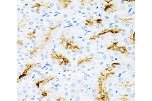 Immunohistochemistry of paraffin-embedded Rat kidney using IL17A Polyclonal Antibody at dilution of 1:100 (40x lens). (Interleukin 17a Antikörper)