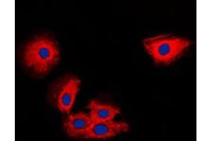 Immunofluorescence (IF) image for anti-Metalloproteinase Inhibitor 2 (TIMP2) (Center) antibody (ABIN7297146)