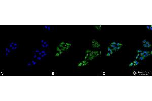 Immunocytochemistry/Immunofluorescence analysis using Rabbit Anti-p53 Polyclonal Antibody . (p53 Antikörper  (C-Term) (APC))