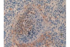 Immunohistochemistry (IHC) image for anti-Dipeptidyl-Peptidase 4 (DPP4) (AA 484-728) antibody (ABIN7432829)