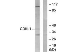 Western blot analysis of extracts from COLO205 cells, using CDKL1 Antibody. (CDKL1 Antikörper  (AA 281-330))