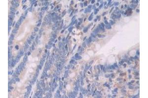 Used in DAB staining on fromalin fixed paraffin- embedded pancreas tissue (UCP1 Antikörper  (AA 179-296))