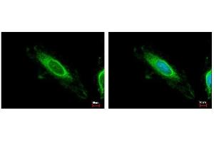 ICC/IF Image TBRG4 antibody detects TBRG4 protein at mitochondria by immunofluorescent analysis. (TBRG4 Antikörper)