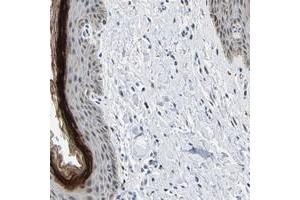 Immunohistochemical staining of human vulva/anal skin with C14orf177 polyclonal antibody  shows distinct positivity in stratum granulosum of squamous epithelium. (C14ORF177 Antikörper)