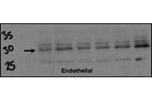 Western blot testing of DSCR1 antibody (1:500) and endothelial cell lysate. (RCAN1 Antikörper  (AA 75-104))