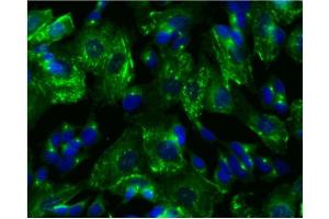 Immunofluorescence (IF) image for anti-Protein Kinase, CAMP-Dependent, Regulatory, Type II, beta (PRKAR2B) (pSer114) antibody (ABIN968875) (PRKAR2B Antikörper  (pSer114))