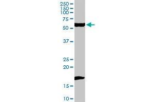 FANCC MaxPab rabbit polyclonal antibody. (FANCC Antikörper  (AA 1-558))