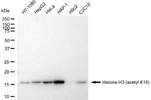 Western blotting analysis using Histone H3 (acetyl K18) antibody (ABIN7798970). (Rekombinanter Histone 3 Antikörper  (H3K18ac))