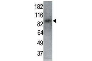 MARK1 antibody used in western blot to detect MARK1 in P7 mouse whole brain lysate (60 ug) at 1:250.