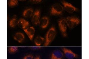 Immunofluorescence analysis of HeLa cells using NDRG4 Polyclonal Antibody at dilution of 1:100. (NDRG4 Antikörper)