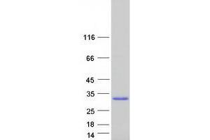 Western Blotting (WB) image for DnaJ (Hsp40) Homolog, Subfamily C, Member 5 beta (DNAJC5B) protein (Myc-DYKDDDDK Tag) (ABIN2719606)