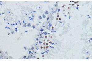 Immunohistochemistry (Paraffin-embedded Sections) (IHC (p)) image for anti-Histone H4 (acLys12) antibody (ABIN7257734)