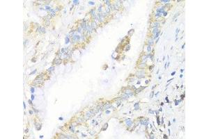 Immunohistochemistry (Paraffin-embedded Sections) (IHC (p)) image for anti-Eukaryotic Translation Initiation Factor 3 Subunit J (EIF3S1) antibody (ABIN7264670)