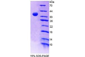 SDS-PAGE (SDS) image for Ribonuclease H2, Subunit A (RNASEH2A) (AA 1-301) protein (His tag) (ABIN6239260)