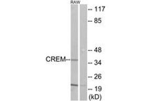 Western blot analysis of extracts from RAW264. (CREM Antikörper  (AA 81-130))