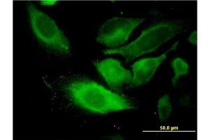 Immunofluorescence of monoclonal antibody to TSSC1 on HeLa cell. (TSSC1 Antikörper  (AA 288-387))