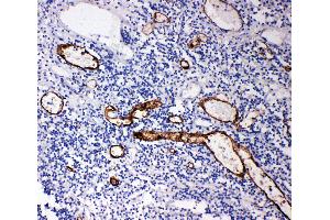 Anti-MAdCAM1 antibody, IHC(P) IHC(P): Human Appendicitis Tissue (MADCAM1 Antikörper  (Middle Region))