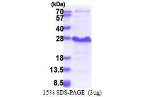 Nedd4 Family Interacting Protein 1 (NDFIP1) (AA 1-116) protein (His tag)