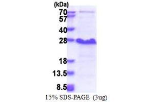 SDS-PAGE (SDS) image for Nedd4 Family Interacting Protein 1 (NDFIP1) (AA 1-116) protein (His tag) (ABIN5853426) (NDFIP1 Protein (AA 1-116) (His tag))