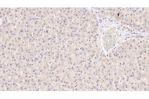 Detection of ENDOG in Human Liver Tissue using Polyclonal Antibody to Endonuclease G, Mitochondrial (ENDOG) (Endonuclease G Antikörper  (AA 16-290))
