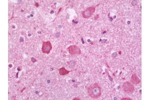 Anti-PLXNC1 / Plexin C1 antibody IHC staining of human brain, cortex. (Plexin C1 Antikörper  (AA 1025-1054))