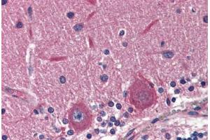 Human Brain, Cerebellum (formalin-fixed, paraffin-embedded) stained with EXOC4 antibody ABIN364381 at 5 ug/ml followed by biotinylated anti-mouse IgG secondary antibody ABIN481714, alkaline phosphatase-streptavidin and chromogen. (Sec8 Antikörper)