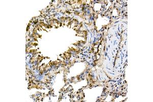 Immunohistochemistry of paraffin-embedded rat lung using ERK1/2 Rabbit mAb (ABIN7268620) at dilution of 1:100 (40x lens). (ERK1 Antikörper)