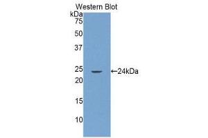 Western Blotting (WB) image for anti-Glutamate Receptor Interacting Protein 1 (GRIP1) (AA 79-268) antibody (ABIN1859070) (GRIP1 Antikörper  (AA 79-268))