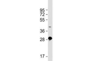 Western blot testing of human skeletal muscle lysate with DNASE1L2 antibody at 1:2000. (DNASE1L2 Antikörper  (AA 199-229))