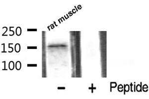 Western blot analysis of VEGFR2 phosphorylation expression in rat muscle tissue lysates,The lane on the right is treated with the antigen-specific peptide. (VEGFR2/CD309 Antikörper  (pTyr1059))
