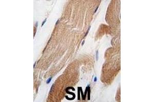 Formalin-fixed and paraffin-embedded human skeletal muscle tissue reacted with ILK Antibody  f antibody, which was peroxidase-conjugated to the secondary antibody, followed by DAB staining. (ILK Antikörper  (AA 151-180))