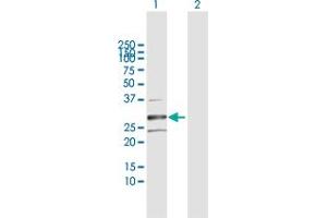 Western Blot analysis of HSD17B8 expression in transfected 293T cell line by HSD17B8 MaxPab polyclonal antibody.