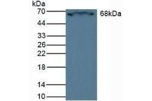 Detection of CRAT in Rat Heart Tissue using Polyclonal Antibody to Carnitine Acetyltransferase (CRAT) (CRAT Antikörper  (AA 55-256))