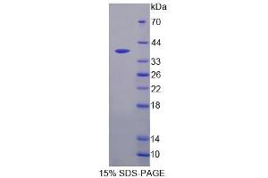 Image no. 1 for RIO Kinase 1 (RIOK1) (AA 180-479) protein (His tag) (ABIN4991115)