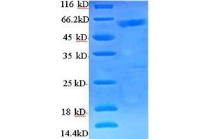 SDS-PAGE (SDS) image for BRCA1/BRCA2-Containing Complex, Subunit 3 (BRCC3) (AA 2-316) protein (His-SUMO Tag) (ABIN5709149) (BRCC3 Protein (AA 2-316) (His-SUMO Tag))