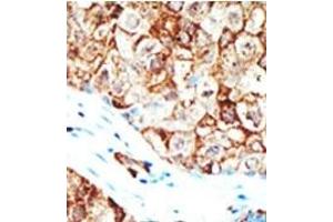 Image no. 2 for anti-Ubiquilin 1 (UBQLN1) (Middle Region) antibody (ABIN357612) (Ubiquilin 1 Antikörper  (Middle Region))