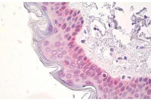 Image no. 2 for anti-SRY (Sex Determining Region Y)-Box 2 (SOX2) (AA 100-150) antibody (ABIN1490795)