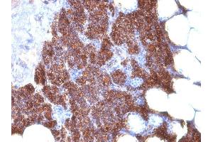 Formalin-fixed, paraffin-embedded human Parathyroid stained with PTH Monoclonal Antibody (3H9 + PTH/1175). (PTH Antikörper  (AA 1-34, AA 32-115))