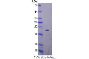 SDS-PAGE analysis of Mouse KLRK1 Protein. (KLRK1 Protein)