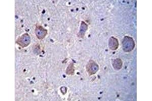 TLR8 antibody immunohistochemistry analysis in formalin fixed and paraffin embedded human brain tissue.