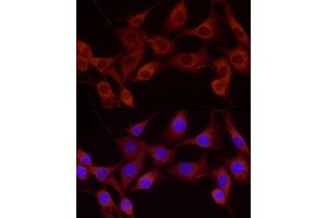 Immunofluorescence analysis of NIH-3T3 using Cortactin antibody (ABIN6127722, ABIN6139243, ABIN6139244 and ABIN6221478) at dilution of 1:25 (40x lens). (Cortactin Antikörper  (AA 214-513))