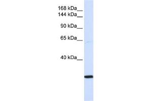 WB Suggested Anti-SMC2 Antibody Titration:  0. (SMC2 Antikörper  (N-Term))