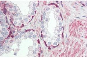 Human Prostate: Formalin-Fixed, Paraffin-Embedded (FFPE) (TRIM59 Antikörper  (Internal Region))