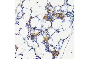 Immunohistochemistry of paraffin-embedded mouse bone marrow using Integrin beta 3 (ITGB3/CD61) Rabbit pAb (ABIN6127572, ABIN6142584, ABIN6142586 and ABIN6219636) at dilution of 1:100 (40x lens).