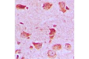 Immunohistochemical analysis of NDUFA8 staining in human brain formalin fixed paraffin embedded tissue section. (NDUFA8 Antikörper  (Center))