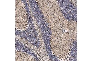 IHC analysis of SFXN5 using anti-SFXN5 antibody (ABIN7601388). (Sideroflexin 5 Antikörper  (AA 34-340))