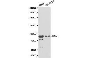 Western Blotting (WB) image for anti-Ribonucleotide Reductase M1 (RRM1) antibody (ABIN1874668) (RRM1 Antikörper)